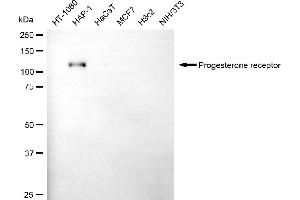 Western blotting analysis using progesterone receptor antibody (ABIN7799906).