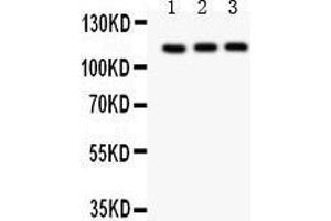 Anti- TRPC5 Picoband antibody, Western blotting All lanes: Anti TRPC5  at 0.