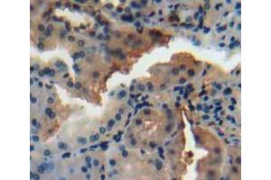 Used in DAB staining on fromalin fixed paraffin-embedded kidney tissue (N-Acetyl alpha-D-Glucosaminidase (AA 485-743) anticorps)