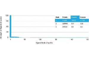 Analysis of Protein Array containing more than 19,000 full-length human proteins using S100B Mouse Monoclonal Antibody (S100B/1012) Z- and S- Score: The Z-score represents the strength of a signal that a monoclonal antibody (MAb) (in combination with a fluorescently-tagged anti-IgG secondary antibody) produces when binding to a particular protein on the HuProtTM array. (S100B anticorps)
