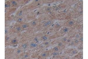 Detection of CD40 in Human Liver Tissue using Polyclonal Antibody to Tumor Necrosis Factor Receptor Superfamily, Member 5 (CD40)