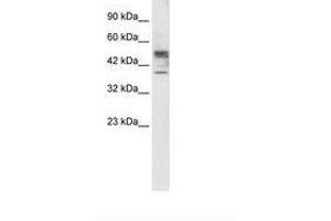 Image no. 2 for anti-Carbohydrate (N-Acetylglucosamine 6-O) Sulfotransferase 4 (CHST4) (AA 156-205) antibody (ABIN202397) (CHST4 anticorps  (AA 156-205))