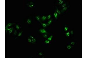 Immunofluorescence staining of HepG2 cells with ABIN7127681 at 1:100,counter-stained with DAPI.