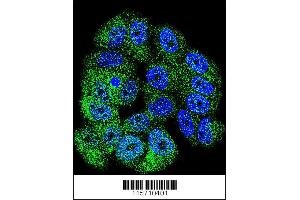 Confocal immunofluorescent analysis of ABL1 Antibody with MCF-7 cell followed by Alexa Fluor 488-conjugated goat anti-rabbit lgG (green). (ABL1 anticorps  (AA 741-769))