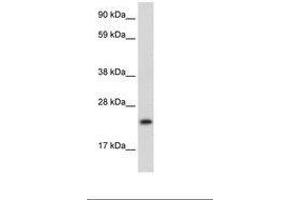Image no. 2 for anti-Achaete-Scute Complex Homolog 1 (Drosophila) (ASCL1) (AA 48-97) antibody (ABIN202101) (ASCL1 anticorps  (AA 48-97))