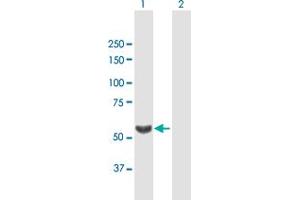 Western Blot analysis of TBL1X expression in transfected 293T cell line by TBL1X MaxPab polyclonal antibody. (TBL1X anticorps  (AA 1-526))