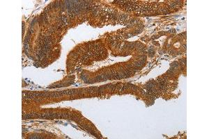 Immunohistochemistry (IHC) image for anti-Notch 3 (NOTCH3) antibody (ABIN3023484)