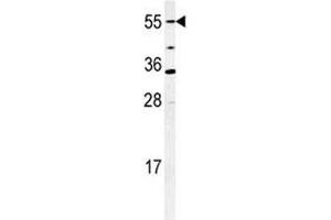 Western blot analysis of CYP26A1 antibody and mouse NIH3T3 cell lysate.