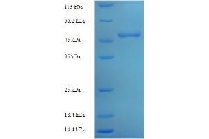 SDS-PAGE (SDS) image for Ornithine Carbamoyltransferase (OTC) (AA 33-354) protein (His-SUMO Tag) (ABIN5710051)