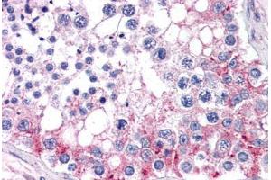 Human Testis (formalin-fixed, paraffin-embedded) stained with ABCB9 antibody ABIN351468 at 3. (ABCB9 anticorps  (AA 757-769))