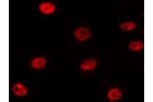 ABIN6275197 staining 293T by IF/ICC. (SIX Homeobox 1 anticorps  (Internal Region))