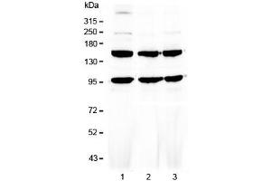 Western blot testing of human 1) HeLa, 2) MCF7 and 3) HepG2 cell lysate with VEGFR3 antibody at 0. (FLT4 anticorps)