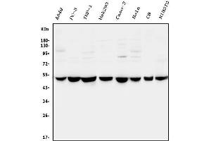 Western blot analysis of CTBP2 using anti-CTBP2 antibody (ABIN3042768). (CTBP2 anticorps  (AA 321-445))