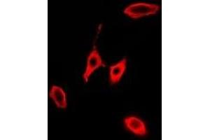 Immunofluorescent analysis of KLK10 staining in A549 cells.