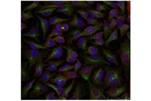 Image no. 1 for anti-Stathmin 1 (STMN1) (Ser24) antibody (ABIN197454)