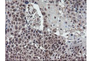 Image no. 3 for anti-Tryptophan 2,3-Dioxygenase (TDO2) antibody (ABIN1501352)