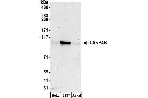 Western Blotting (WB) image for anti-La Ribonucleoprotein Domain Family, Member 4B (LARP4B) (AA 450-500) antibody (ABIN7450404)