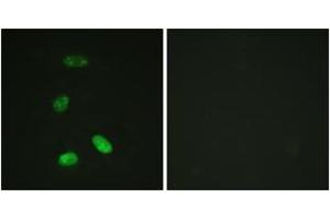 Immunofluorescence analysis of HeLa cells, using MYB (Ab-12) Antibody.