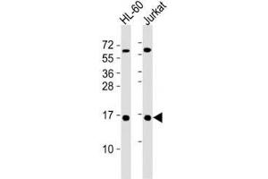 Western blot testing of SUMO1 antibody at 1:4000 dilution.