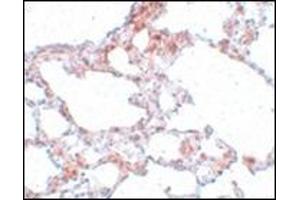 Immunohistochemistry of MRE11 in rat lung tissue with MRE11 antibody at 5 μg/ml.