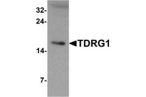 Western blot analysis of TDRG1 in human testis tissue lysate with TDRG1 Antibody  at 1 μg/ml (TDRG1 anticorps  (Middle Region))