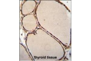 NFKBID Antibody (N-term) (ABIN655836 and ABIN2845251) immunohistochemistry analysis in formalin fixed and paraffin embedded human thyroid tissue followed by peroxidase conjugation of the secondary antibody and DAB staining.