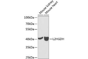 Western blot analysis of extracts of various cell lines, using L2HGDH antibody (ABIN6132151, ABIN6143055, ABIN6143056 and ABIN6224014) at 1:1000 dilution. (L2HGDH anticorps  (AA 1-220))