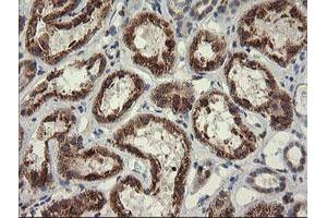 Image no. 9 for anti-Pogo Transposable Element with KRAB Domain (POGK) antibody (ABIN1500328)