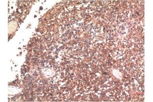Immunohistochemical analysis of paraffin-embedded Human Brain Tissue using Tau Mouse mAb diluted at 1:200.