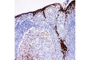 Anti-Cystatin A antibody, IHC(P) IHC(P): Human Tonsil Tissue (CSTA anticorps  (C-Term))