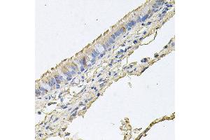 Immunohistochemistry of paraffin-embedded human trachea using EPOR antibody at dilution of 1:100 (x40 lens). (EPOR anticorps)