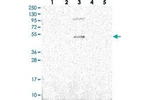 Western blot analysis of Lane 1: RT-4, Lane 2: U-251 MG, Lane 3: Human Plasma, Lane 4: Liver, Lane 5: Tonsil with SLC10A5 polyclonal antibody . (SLC10A5 anticorps)