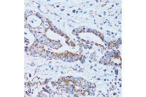 Immunohistochemistry of paraffin-embedded human colon carcinoma using GIP antibody (ABIN1882357) at dilution of 1:100 (40x lens). (GIP anticorps)