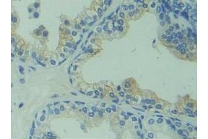Detection of CAPS in Human Prostate Tissue using Polyclonal Antibody to Calcyphosine (CAPS)