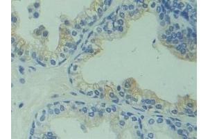 Detection of CAPS in Human Prostate Tissue using Polyclonal Antibody to Calcyphosine (CAPS) (Calcyphosine anticorps  (AA 1-189))