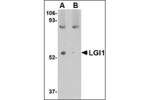 Western blot analysis of LGI1 in mouse brain tissue lysate with this product at 1 μg/ml in (A) the absence and (B) the presence of blocking peptide. (LGI1 anticorps  (N-Term))
