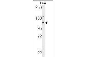 ADCY4 antibody  (AA 415-441)
