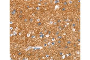 Immunohistochemistry (IHC) image for anti-Synuclein, alpha (SNCA) antibody (ABIN2434303) (SNCA anticorps)