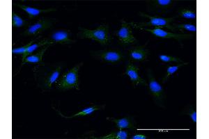 Immunofluorescence of monoclonal antibody to MSN on HeLa cell.
