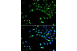 Immunofluorescence analysis of A549 cells using HOXA1 antibody (ABIN5974165). (HOXA1 anticorps)