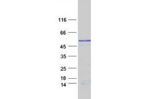 Validation with Western Blot