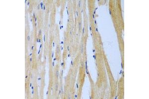 Immunohistochemistry of paraffin-embedded rat heart using MGAT3 antibody at dilution of 1:100 (40x lens). (MGAT3 anticorps)