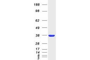 Validation with Western Blot