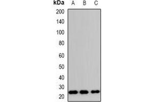 Western blot analysis of TP53INP2 expression in HeLa (A), RAW264.