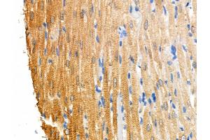 Phospho-RIPK3 (Ser199) Antibody at 1/100 staining Rat heart tissue by IHC-P.
