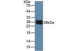 Detection of TIGIT in Rat Serum using Polyclonal Antibody to T-Cell Immunoreceptor With Ig And ITIM Domains Protein (TIGIT) (TIGIT anticorps  (AA 28-227))