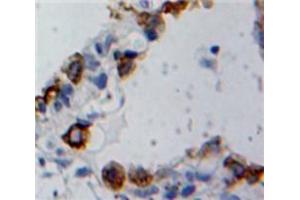 Used in DAB staining on fromalin fixed paraffin-embedded Ovary tissue (Cofilin 2 anticorps  (AA 1-156))