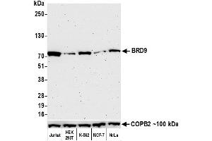 Western Blotting (WB) image for anti-Bromodomain Containing 9 (BRD9) (AA 547-597) antibody (ABIN7455162) (Recombinant BRD9 anticorps  (AA 547-597))