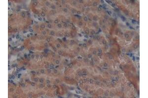 DAB staining on IHC-P; Samples: Mouse Kidney Tissue (GALNS anticorps  (AA 168-377))