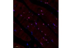 Immunofluorescence of paraffin embedded rat skeletal muscle using BCMA (ABIN7076067) at dilution of 1: 600 (250x lens)